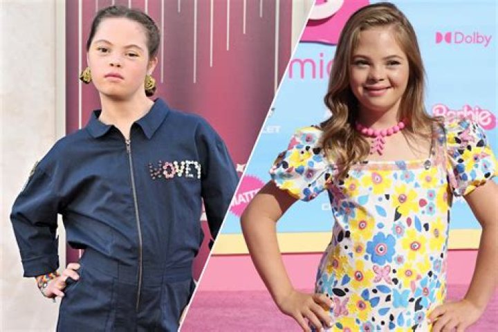 Unveiling The Journey Of A Down Syndrome Girl In The Hunger Games